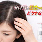 スカルプD ボーテは50代の分け目に効果ある？ぺたんこ対策まとめ