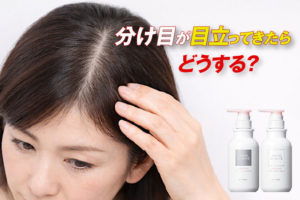 スカルプD ボーテは50代の分け目に効果ある？ぺたんこ対策まとめ